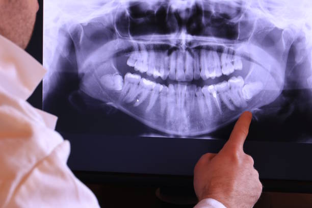 Best After-Hours Emergency Dentist in Midland City, AL